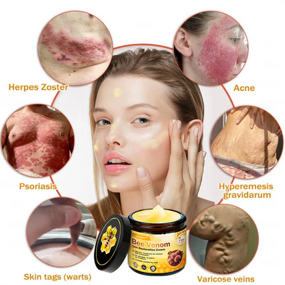 Made and Shipped from USA ✨Cougex® Bee Venom Skin Restoration Cream ⏰ LAST DAY 80% OFF